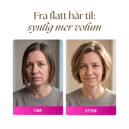 Rota Løft|Elektrisk Stylebrush for kort hår